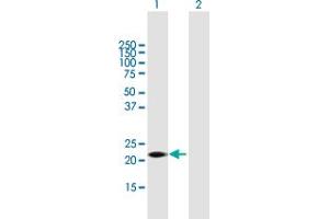 Western Blot analysis of GSTK1 expression in transfected 293T cell line by GSTK1 MaxPab polyclonal antibody. (GSTK1 抗体  (AA 1-226))