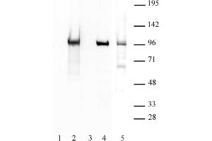 BORIS / CTCFL antibody (pAb) tested by Western blot.