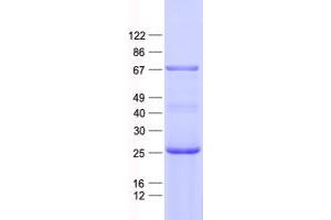 Validation with Western Blot (CEP63 Protein (His tag))