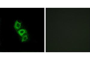 Peptide - +Immunohistochemistry analysis of paraffin-embedded human liver carcinoma tissue using APOL5 antibody. (Apolipoprotein L 5 抗体)