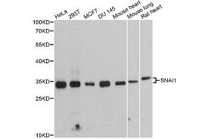 Western blot analysis of extracts of various cell lines, using SNAI1 antibody (ABIN4905248) at 1:1000 dilution. (SNAIL 抗体)