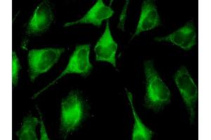 Immunofluorescence of monoclonal antibody to FAU on HeLa cell. (FAU 抗体  (AA 1-133))