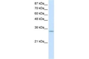 Western Blotting (WB) image for anti-Protein Kinase, Interferon-Inducible Double Stranded RNA Dependent Activator (PRKRA) antibody (ABIN2462150) (PRKRA 抗体)