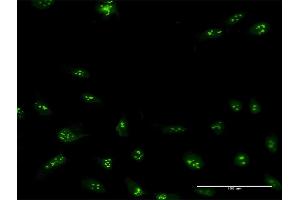 Immunofluorescence of purified MaxPab antibody to NIP7 on HeLa cell. (NIP7 抗体  (AA 1-180))