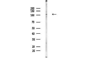 Western blot analysis of lysates from Hela cells(heat-shock,45 min treatment), using RHG17 Antibody at 1/1000 dilution.