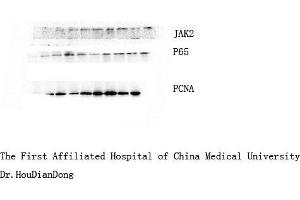Western Blot (WB) analysis: Please contact us for more details. (NF-kB p65 抗体)