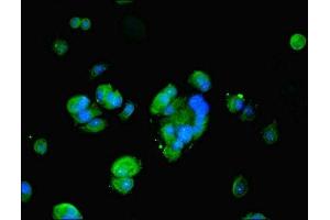 Immunofluorescent analysis of MCF-7 cells using ABIN7162823 at dilution of 1:100 and Alexa Fluor 488-congugated AffiniPure Goat Anti-Rabbit IgG(H+L) (FKBP1A 抗体  (AA 2-103))