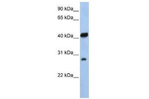WB Suggested Anti-ZFAND3 Antibody Titration:  0. (ZFAND3 抗体  (N-Term))