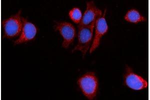 IF analysis of PDE4DIP using anti-PDE4DIP antibody (ABIN7602691). (PDE4DIP 抗体  (AA 96-1254))
