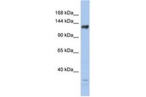 Image no. 1 for anti-Lysine (K)-Specific Demethylase 4B (KDM4B) (AA 359-408) antibody (ABIN6744254)
