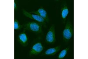 IF analysis of Cofilin 2 using anti-Cofilin 2 antibody (ABIN4886538).