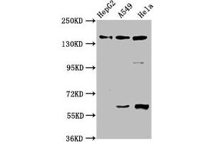 Western Blot Positive WB detected in: HepG2 whole cell lysate, A549 whole cell lysate, Hela whole cell lysate All lanes: NAIP antibody at 3. (NAIP 抗体  (AA 147-242))