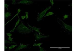 Immunofluorescence of monoclonal antibody to IRAK4 on HeLa cell. (IRAK4 抗体  (AA 255-351))