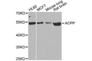 Western blot analysis of extracts of various cell lines, using ACPP antibody. (ACPP 抗体  (AA 40-300))