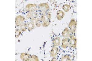 Immunohistochemistry of paraffin-embedded human stomach using YAP1 antibody. (YAP1 抗体)