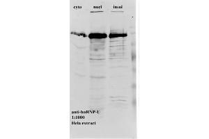 Western blot of anti-hnRNP-U on HeLa cell extract (HNRNPU 抗体)