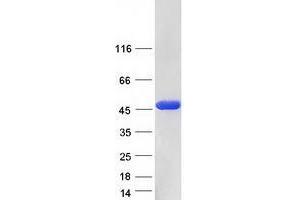 Western Blotting (WB) image for Tissue Specific Transplantation Antigen P35B (TSTA3) protein (Myc-DYKDDDDK Tag) (ABIN2734463)