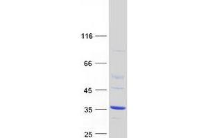 Validation with Western Blot