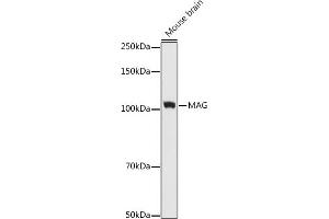Western blot analysis of extracts of Mouse brain cells, using MAG antibody (ABIN7268718) at 1:1000 dilution. (MAG 抗体)
