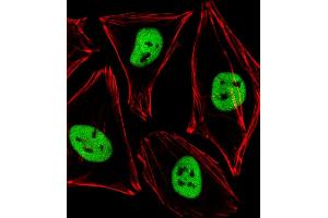 Immunofluorescent analysis of 4 % paraformaldehyde-fixed, 0. (PDX1 抗体  (AA 136-169))