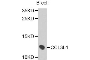 Western blot analysis of extracts of B-cell cells, using CCL3L1 antibody (ABIN5975772) at 1/1000 dilution.