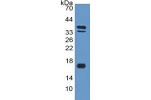 Mouse Capture antibody from the kit in WB with Positive Control: Sample Human Skeletal muscle lysate. (BNP ELISA 试剂盒)