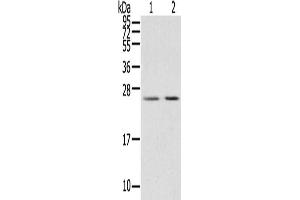 Gel: 12 % SDS-PAGE, Lysate: 40 μg, Lane 1-2: Human breast infiltrative duct tissue, Human placenta tissue, Primary antibody: ABIN7191460(MIG7 Antibody) at dilution 1/200, Secondary antibody: Goat anti rabbit IgG at 1/8000 dilution, Exposure time: 15 seconds (TOX4 抗体)