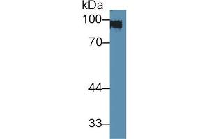 Western blot analysis of Rat Skin lysate, using Rabbit Anti-Mouse KRT1 Antibody (3 µg/ml) and HRP-conjugated Goat Anti-Rabbit antibody (abx400043, 0. (Cytokeratin 1 抗体  (AA 189-497))