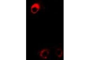 Immunofluorescent analysis of DDAH2 staining in Hela cells. (DDAH2 抗体)