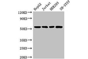Western Blot Positive WB detected in: HepG2 whole cell lysate, Jurkat whole cell lysate, HEK293 whole cell lysate, SH-SY5Y whole cell lysate All lanes: DCTN4 antibody at 3. (Dynactin 4 抗体  (AA 2-460))