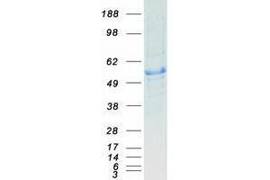 Western Blotting (WB) image for Glucokinase (Hexokinase 4) (GCK) (Transcript Variant 3) protein (Myc-DYKDDDDK Tag) (ABIN2721957)