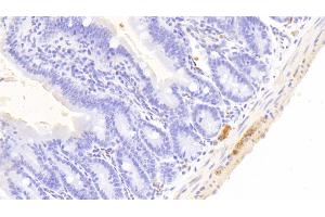 Immunohistochemistry (IHC) image for anti-Ubiquitin Carboxyl-terminal Esterase L1 (Ubiquitin Thiolesterase) (UCHL1) (AA 2-223) antibody (ABIN7440260)