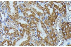 Immunohistochemistry (Paraffin-embedded Sections) (IHC (p)) image for anti-Tubulin Folding Cofactor B (TBCB) antibody (ABIN7256748)