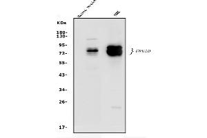Western blot analysis of GRB10 using anti-GRB10 antibody (ABIN7599204).