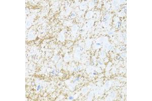 Immunohistochemistry of paraffin-embedded rat brain using CNP antibody. (Cnpase 抗体  (AA 152-421))