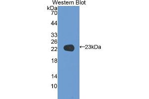 Western blot analysis of the recombinant protein. (Coagulation Factor V 抗体  (AA 1941-2095))