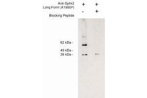 Image no. 1 for anti-Sphingosine Kinase 2 (SPHK2) (Long Isoform), (N-Term) antibody (ABIN4620350) (SPHK2 抗体  (Long Isoform, N-Term))
