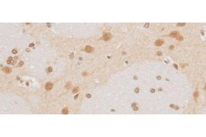 Immunohistochemistry of paraffin-embedded Rat brain using MAP2K6 Polyclonal Antibody at dilution of 1:50