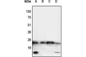 Western blot analysis of TNF alpha expression in HeLa (A), NIH3T3 (B), mouse heart (C), rat brain (D) whole cell lysates. (TNF alpha 抗体  (Center))