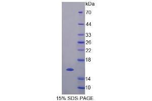 SDS-PAGE analysis of Human ELOC Protein. (TCEB1 蛋白)