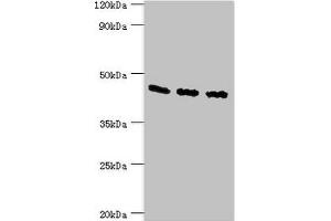 Western blot All lanes: Flotillin-2 antibody at 4 μg/mL Lane 1: A549 whole cell lysate Lane 2: Hela whole cell lysate Lane 3: Rat brain tissue Secondary Goat polyclonal to rabbit IgG at 1/10000 dilution Predicted band size: 47 kDa Observed band size: 47 kDa (Flotillin 2 抗体  (AA 239-428))