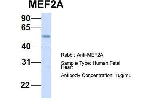 Host:  Rabbit  Target Name:  MEF2A  Sample Type:  Human Fetal Heart  Antibody Dilution:  1. (MEF2A 抗体  (Middle Region))