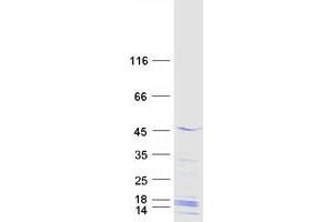 Western Blotting (WB) image for Melanoma Antigen Family B, 18 (MAGEB18) protein (Myc-DYKDDDDK Tag) (ABIN2725208)