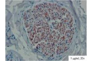 anti-Peripheral Myelin Protein 22 (PMP22) (Extracellular Domain) antibody