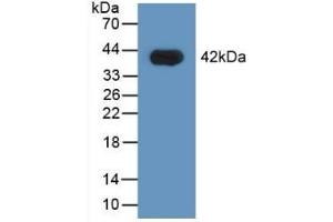 Detection of Recombinant HNRPA1, Human using Polyclonal Antibody to Heterogeneous Nuclear Ribonucleoprotein A1 (HNRNPA1) (HNRNPA1 抗体  (AA 2-372))