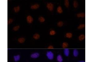 Immunofluorescence analysis of U-2 OS cells using GLI2 Polyclonal Antibody at dilution of 1:100. (GLI2 抗体)
