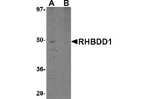 Western blot analysis of RHBDD1 in K562 cell lysate with RHBDD1 antibody at 1 µg/mL in (A) the absence and (B) the presence of blocking peptide. (RHBDD1 抗体  (C-Term))
