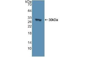 Detection of Recombinant ADCY3, Human using Polyclonal Antibody to Adenylate Cyclase 3 (ADCY3) (ADCY3 抗体  (AA 501-736))