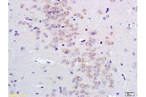 Immunohistochemistry (IHC) image for anti-gamma-aminobutyric Acid (GABA) A Receptor, alpha 2 (GABRA2) (AA 185-280) antibody (ABIN1387528)