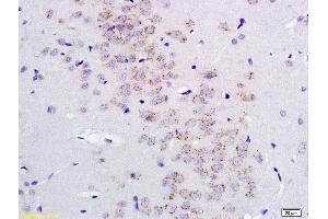 Formalin-fixed and paraffin embedded rat brain labeled with Anti GABRA2/GABA A Receptor alpha 2 Polyclonal Antibody, Unconjugated (ABIN1387528) at 1:200 followed by conjugation to the secondary antibody and DAB staining (GABRA2 抗体  (AA 185-280))